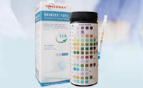 Chemical Urinalysis Strips
